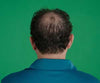 Hair Grow Max 2x1 a 1.261 CZK