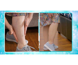 Veins Gone 2x1 a 972 CZK