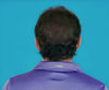 Hair Grow Max 2x1 a 20.021,60 HUF